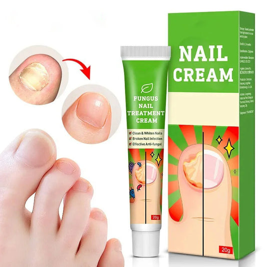 Fungal Nail Treatment Cream